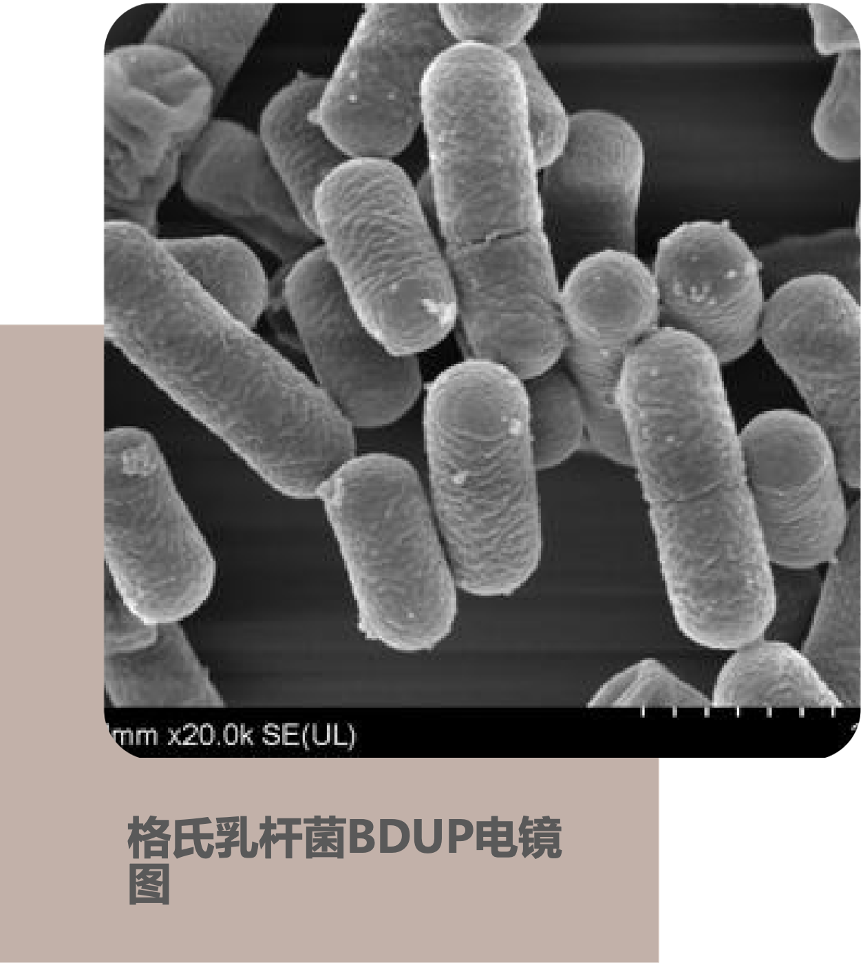 格氏乳杆菌BDUP电镜图